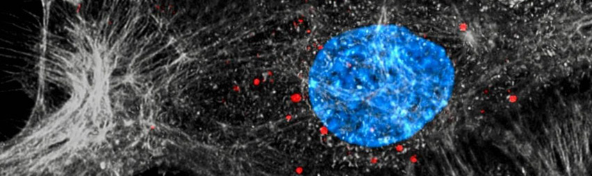 Imagen del artículo: Terapia neoadyuvante: Golpear al tumor antes de la cirugía