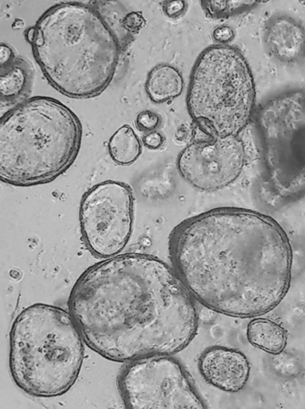 my-scientific-criptas-totalmente-cerradas-y-formando-organoides-tras-dos-das-de-cultivo